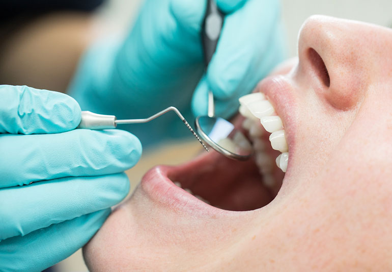 8 signs that you need the expert dental care